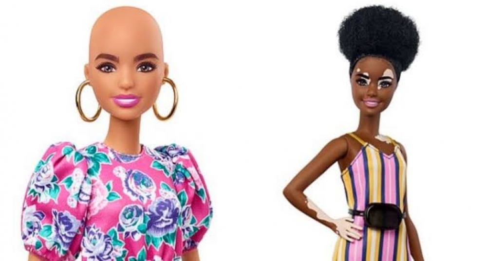 barbie com vitiligo