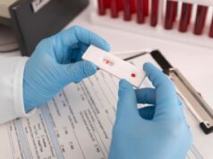 testagem teste rápido HIV
