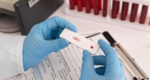 testagem teste rápido HIV